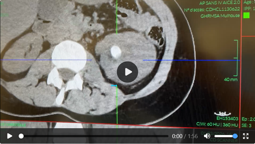 Case 01 imaging