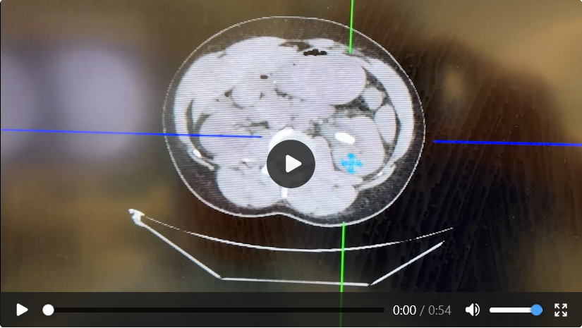 Case 02 imaging