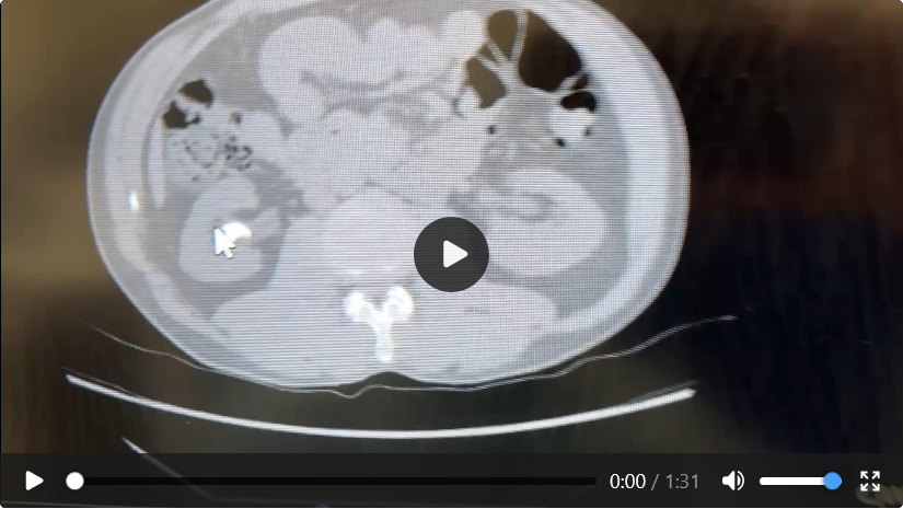 Case 03 imaging