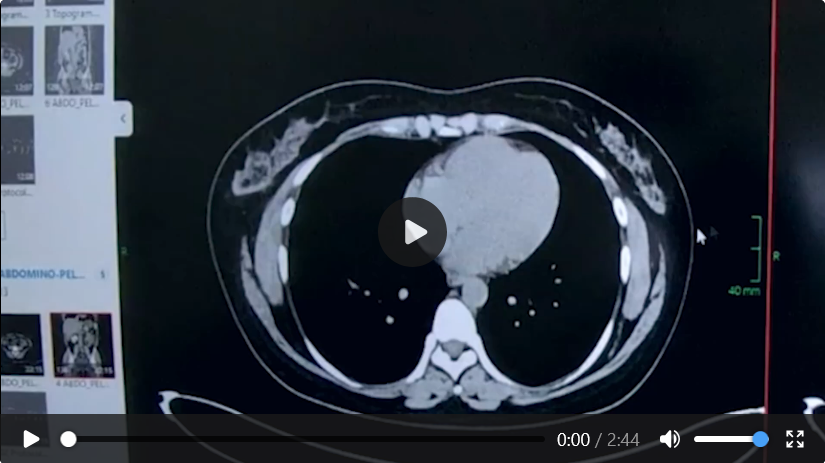 Case 04 imaging