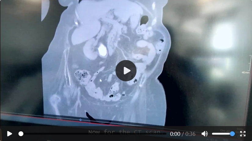 Case 05 imaging