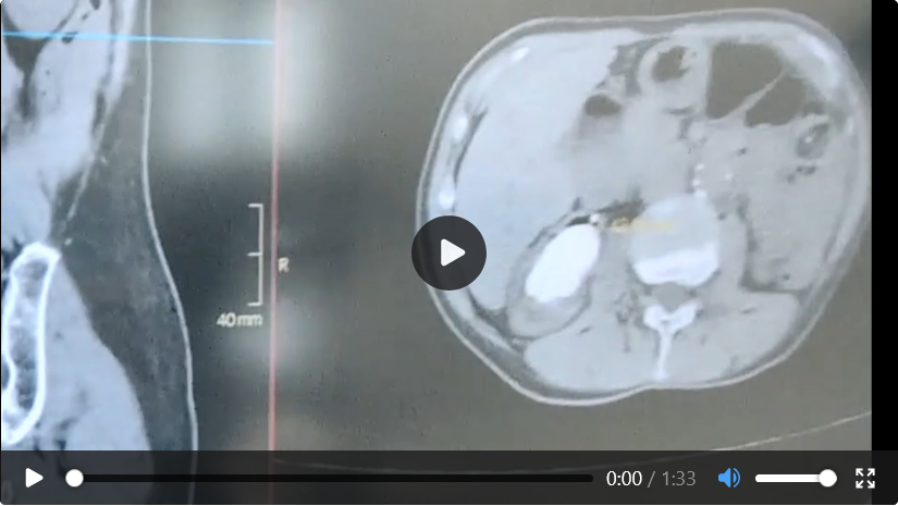 Case 06 imaging