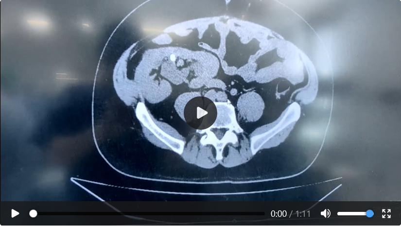Case 07 imaging